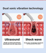 Ultrasonic Skin Scrubber Facial Spatula Blackhead Remover & Pore Cleaner with Ion EMS Lifting Mode Rechargeable Beauty Tool Pink