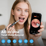 White Wireless Visual Ear Wax & Tonsil Stone Remover with HD Endoscope Camera - 2-in-1 Oral & Ear Care Cleaner for iOS & Android - Front View