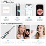 White Wireless Visual Ear Wax & Tonsil Stone Remover with HD Endoscope Camera - 2-in-1 Oral & Ear Care Cleaner for iOS & Android - 45-Degree Angle